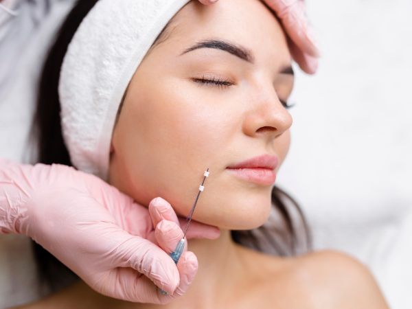 harmonizao-facial-porto-feliz-elaine-fios-de-sustentacao